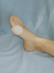 ADHESIVE FINE BUNION PADS.